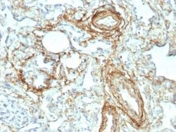 Elastin Antibody (ELN/2069) - Azide and BSA Free, Novus Biologicals 100 &mu;g | Buy Online | Novus Biologicals | Fisher Scientific